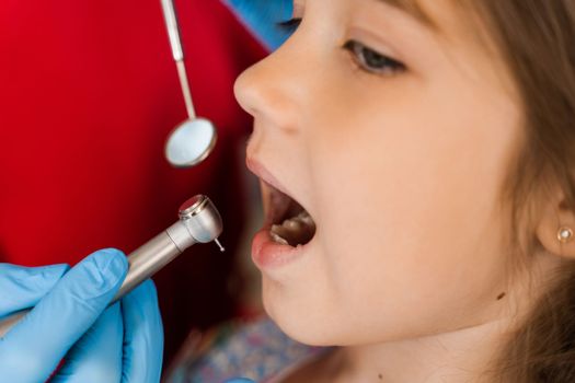 Dental drill close-up. Child dentist drilling teeth of kid girl in dentistry clinic. Teeth treatment. Dental filling for child patient