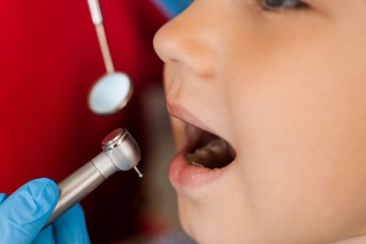 Dental drill close-up. Child dentist drilling teeth of kid girl in dentistry clinic. Teeth treatment. Dental filling for child patient