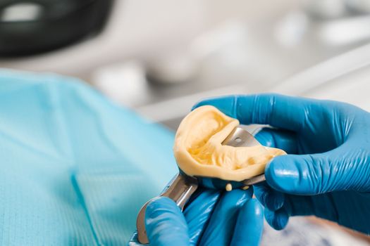 Dental cast of teeth of jaw close-up. Visiting dentist before dental implantation. Procedure of creating dental prostheses, crowns and aligners