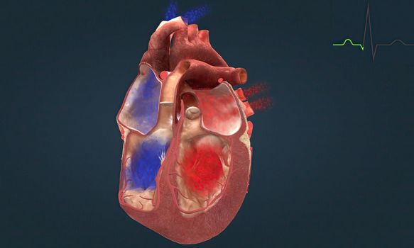 Each time your heart beats, electrical signals travel through your heart. These signals cause different parts of your heart to expand and contract. 3D illustration