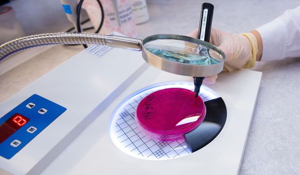Hand Holds Petri Dish with Bacteria Culture