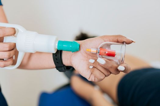 Close up of professional performing cupping treatment on patient, Modern Physiotherapy with cupping cups, Physiotherapist placing cupping on lying patient