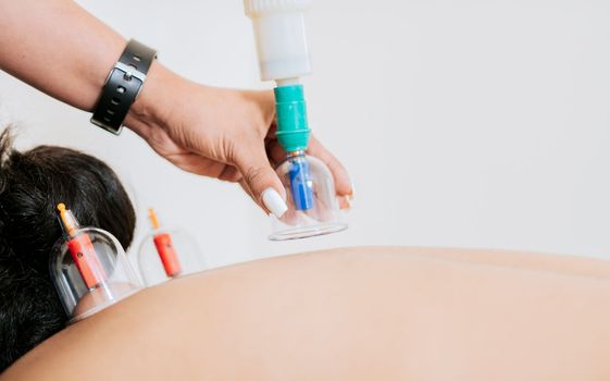 Professional hands placing therapeutic cupping. Physiotherapist placing cupping on patient, Professional physiotherapy treatment with cupping on a lying patient. Modern physiotherapy with cupping