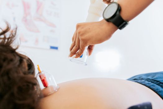 Physiotherapist placing cupping on patient, Professional physiotherapy treatment with cupping on a lying patient. Modern physiotherapy with cupping, Professional hands placing therapeutic cupping