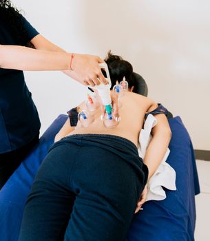 Physiotherapist Applying Cupping Techniques on patient. Modern physiotherapy with cupping, Professional hands placing therapeutic cupping. Physiotherapist placing cupping on patient