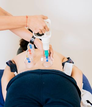 Physiotherapist placing cupping on patient, Physiotherapist placing cupping on lying patient. Modern physiotherapy with cupping, Hands of physiotherapist placing cupping on patient