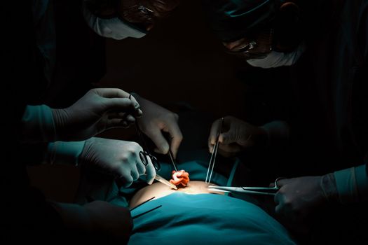 Surgical team performing surgery to patient in sterile operating room. In a surgery room lit by a lamp, a professional and confident surgical team provides medical care to an unconscious patient.