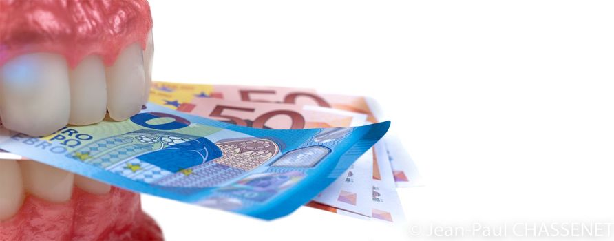 Educational dental typodon model and euro banknotes on white background. Expensive treatment