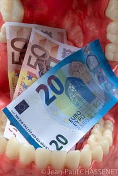 Educational dental typodon model and euro banknotes on white background. Expensive treatment