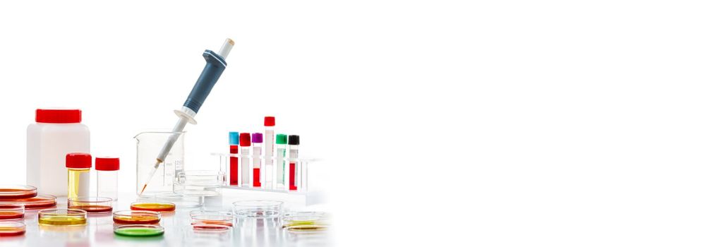 Research in laboratory analysis - Test tubes and Petri dishes with blood samples for analysis on table in laboratory urine sample