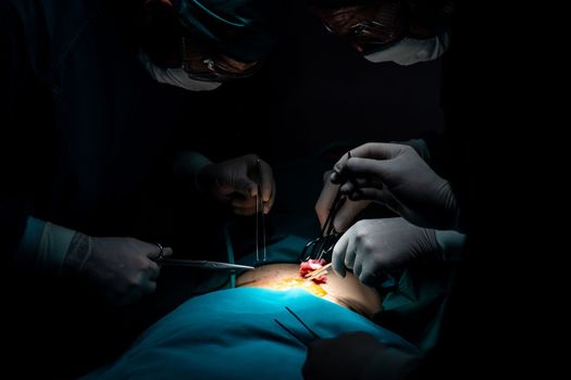 Surgical team performing surgery to patient in sterile operating room. In a surgery room lit by a lamp, a professional and confident surgical team provides medical care to an unconscious patient.