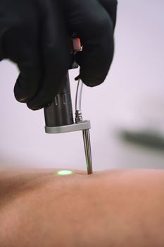 Close up shot of gloved hand with the laser hair removal machine's handpiece along woman hand. Alexandrite laser techhnology removing hair. Beauty procedureBeauty technology concept