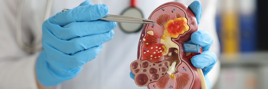 Urology and treatment of kidney diseases. Doctor performing a kidney examination on a female patient with kidney disease