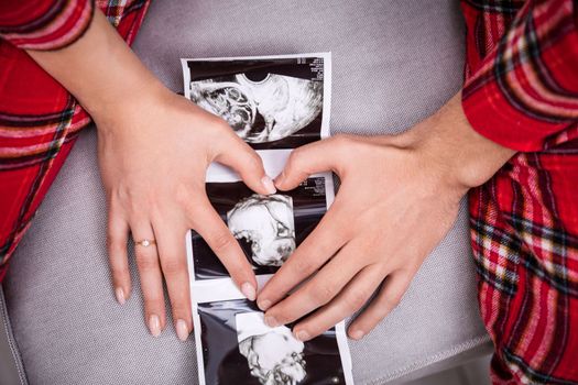 An usg photo of a baby lies on a gray sofa. A woman and a man put their hands on the usg photo, forming a heart shape from their palms. The parents-to-be are wearing the same plaid pajamas.