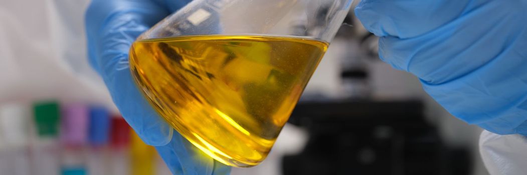 Chemist in gloves holds test tube with yellow oily liquid for research closeup. Laboratory research materials urine or oil toxic and poisonous concept