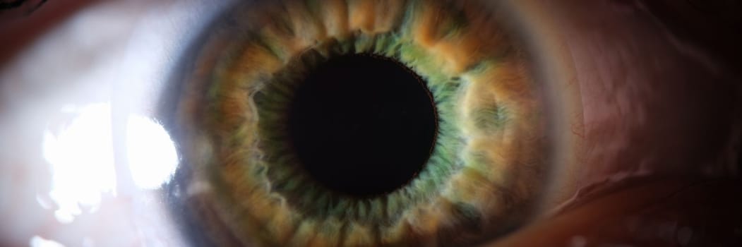 Closeup of female grey green eye with contact lens. Diagnosis and correction of myopia concept