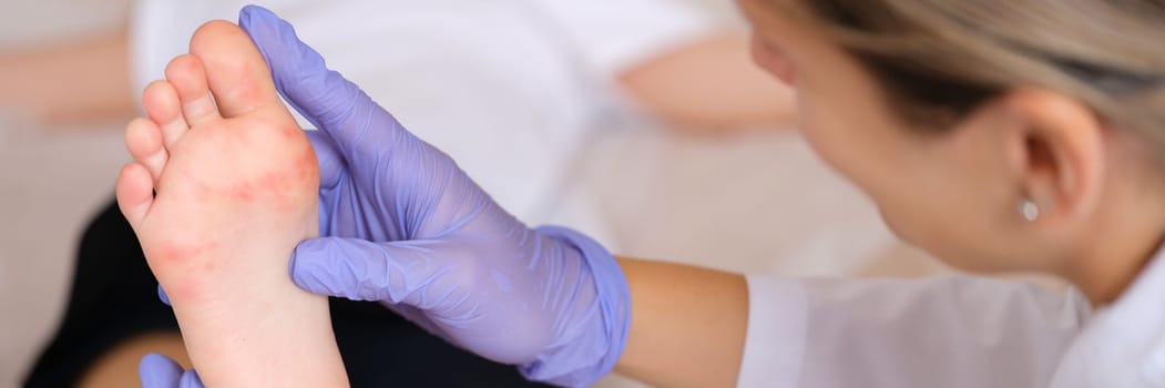 Doctor examining foot of child with red itchy rashes in clinic closeup. Enterovirus infection symptoms hand-foot-mouth concept