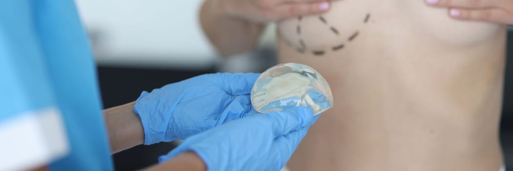 Doctor draws marks on female breast before cosmetic surgery operation and holds silicone implant. Breast augmentation and lift concept