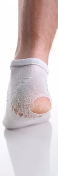 Torn white sock on man leg closeup. Poverty poverty and wear socks concept