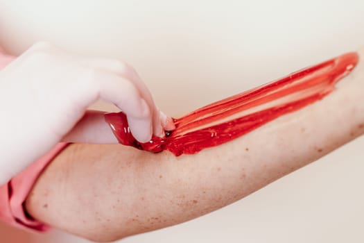 Shugaring master applying thick sugar paste on lady's hand, removing unwanted hair. Hair removal with a special sugar paste has many advantages over wax depilation.