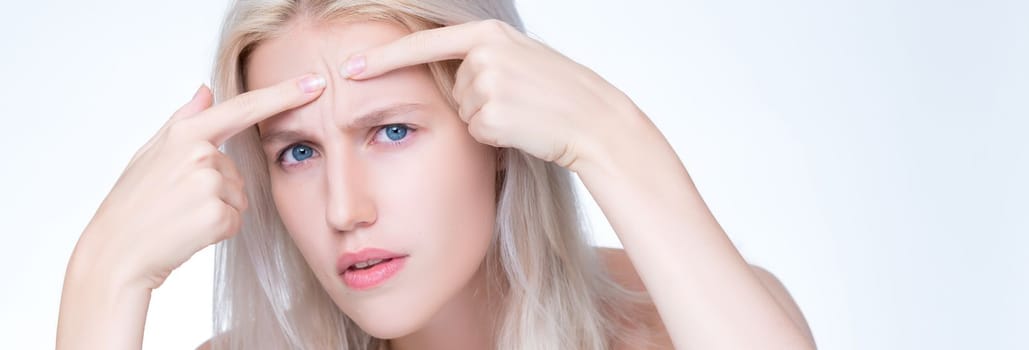 Acne problem troubling closeup personable worried woman with natural beauty skin checking her face squeezing pimple spots in isolated background. Copyspace for blemish skincare treatment problem.