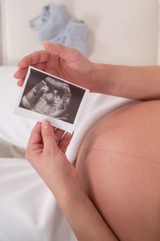 A faceless pregnant woman sits on a white sofa and holds an ultrasound photo of the fetus