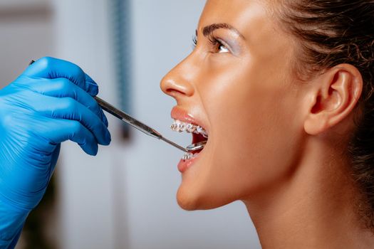 Close-up of a dentist checking braces with a dental mirror on the female patient. 