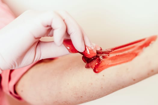 Shugaring master applying thick sugar paste on lady's hand, removing unwanted hair. Hair removal with a special sugar paste has many advantages over wax depilation.