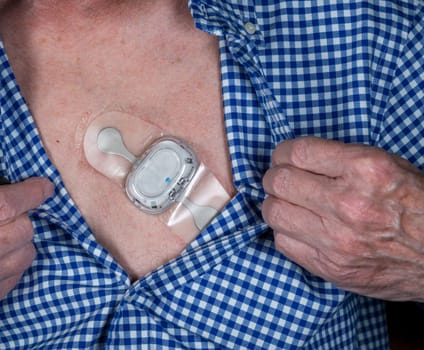 Small adhesive heart ECG long term heart rate monitor on male chest