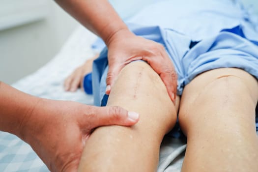 Doctor checking Asian elderly woman patient with scar knee replacement surgery in hospital.