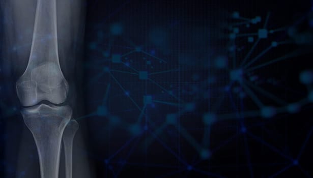 Film x-ray of Left knee joint AP view for Medical background 3D rendering.