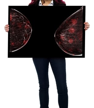 breast cancer awareness against woman for fight against breast cancer showing X-ray Digital Mammogram isolated on white background. Clipping path.