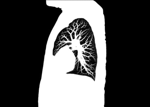 CT scan of Chest or lung sagittal view at radiology department in hospital. Covid-19 scan body xray test detection for covid virus epidemic spread concept