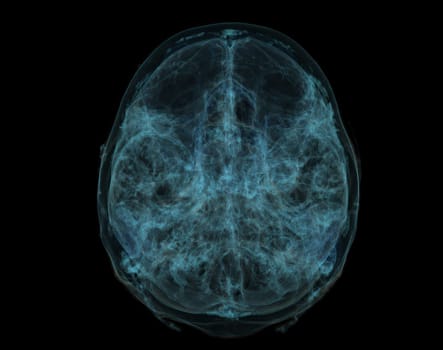 Human Skull, Brain by CT Scan. X-ray Visualization Inside Of Skull. 3D Illustration Render.