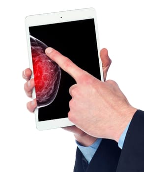 The doctor using digital tablet against X-ray Digital Mammogram isolated on white background. breast cancer awareness against woman for fight against breast cancer .