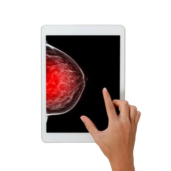 The doctor using digital tablet against X-ray Digital Mammogram isolated on white background. breast cancer awareness against woman for fight against breast cancer .