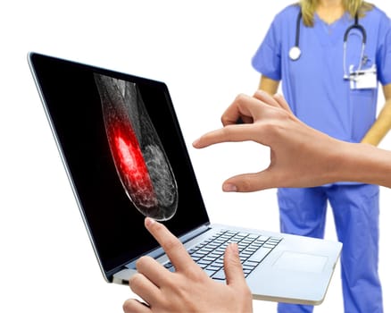 The doctor using digital tablet against X-ray Digital Mammogram isolated on white background. breast cancer awareness against woman for fight against breast cancer .