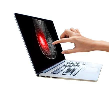 The doctor using digital tablet against X-ray Digital Mammogram isolated on white background. breast cancer awareness against woman for fight against breast cancer .