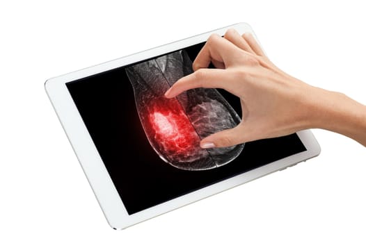 The doctor using digital tablet against X-ray Digital Mammogram isolated on white background. breast cancer awareness against woman for fight against breast cancer .