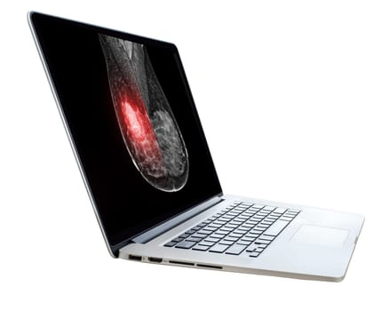 The doctor using digital tablet against X-ray Digital Mammogram isolated on white background. breast cancer awareness against woman for fight against breast cancer .