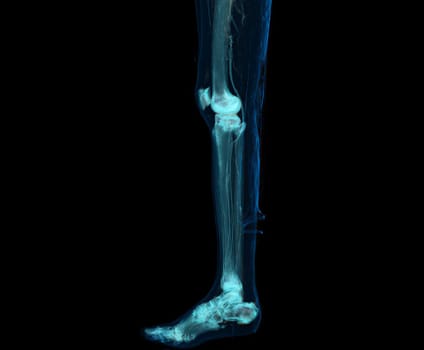 3D render of lower extremity or legs isolated on black background.