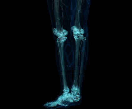 3D render of lower extremity or legs isolated on black background.