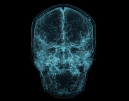 Human Skull, Brain by CT Scan. X-ray Visualization Inside Of Skull. 3D Illustration Render.