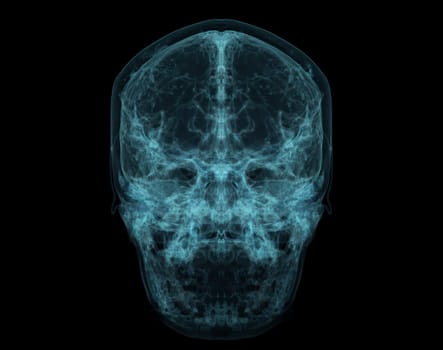 Human Skull, Brain by CT Scan. X-ray Visualization Inside Of Skull. 3D Illustration Render.