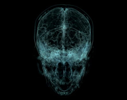 Human Skull, Brain by CT Scan. X-ray Visualization Inside Of Skull. 3D Illustration Render.