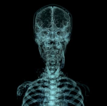 Human Skull, Brain by CT Scan. X-ray Visualization Inside Of Skull. 3D Illustration Render.