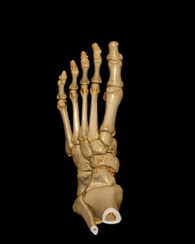 3D rendering of the foot bones for diagnosis bone fracture and rheumatoid arthritis from CT scannner.