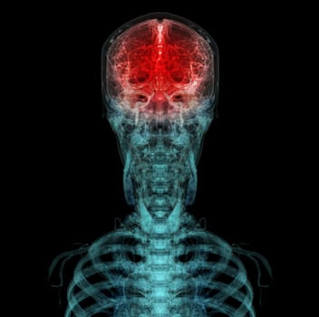 3D rendered medically accurate illustration of the cerebral artery of the head