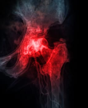 3D rendering Pelvic bone and hip joint 3D isolated on black background.