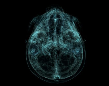 Human base of Skull, Brain by CT Scan. X-ray Visualization Inside Of Skull. 3D Illustration Render.